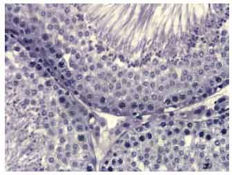 Image for - Anti-spermatogenic Activity of Leptadenia hastata (Pers.) Decne Leaf Stems Aqueous Extracts in Male Wistar Rats
