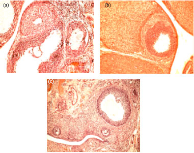 Image for - Potential Amelioration of Curcumin Against Nicotine-induced Toxicity of Protein Malnourished Female Rats
