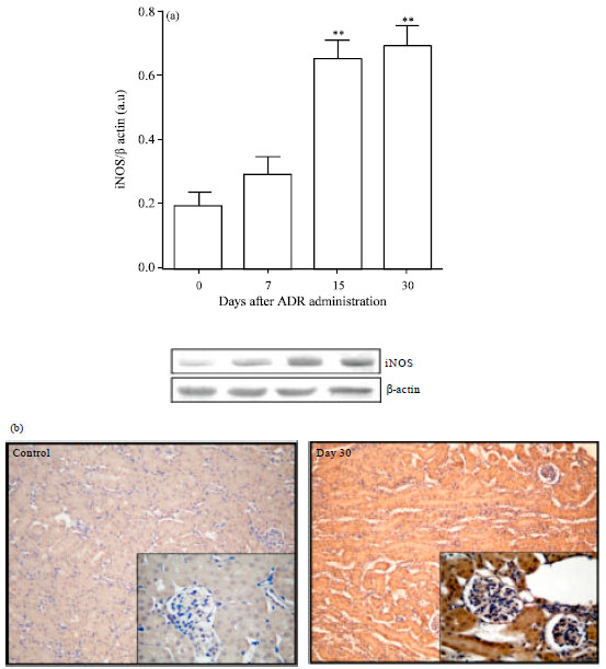 Image for - Cell Stress, Hypoxic Response and Apoptosis in Murine Adriamycin-induced Nephropathy