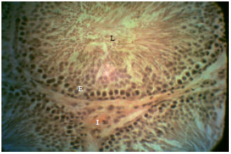 Image for - Rhodinol-based Incense Testiculotoxicity in Albino Rats: Testicular Histology, Spermatogenic and Biochemical Evaluations