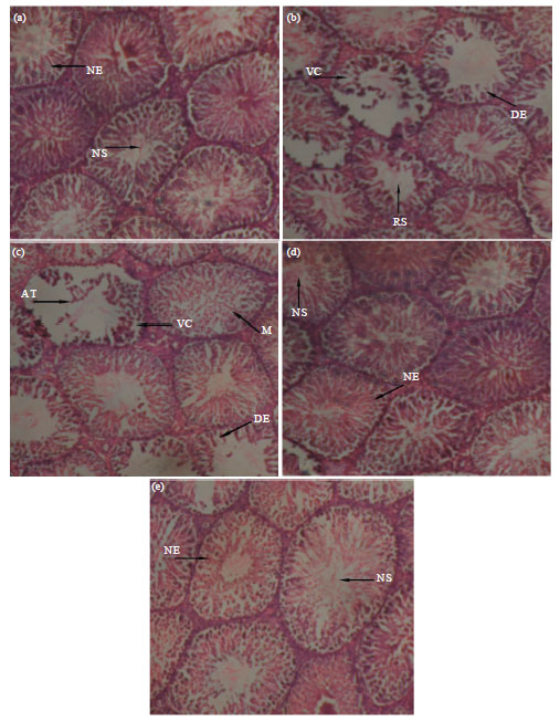 Image for - Protective Effect Of Ascorbic Acid On Cimetidine-Induced Reproductive Toxicity  In Male Wistar Rats