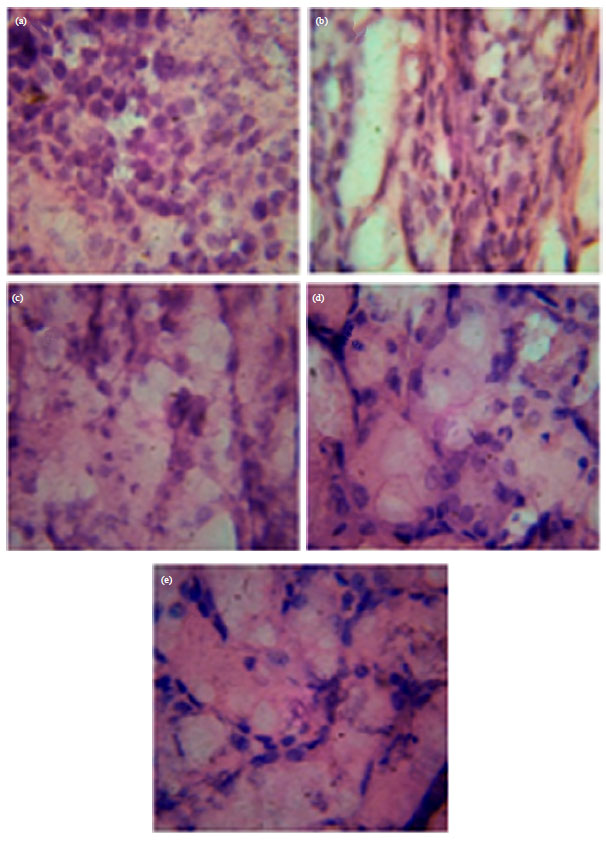 Image for - Prevention of Cisplatin-Induced Renal Toxicity in Swiss Albino Mice by Astaxanthine