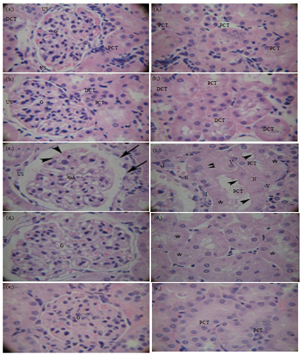 Image for - Antioxidant Effect of Silymarin on Cisplatin-Induced Renal Oxidative Stress in Rats