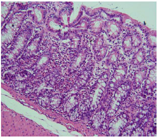 Image for - Healing Effects of Elaeagnus angustifolia Extract in Experimentally Induced Ulcerative Colitis in Rats