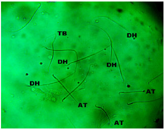 Image for - Evidences for Spermatozoa Toxicity and Oxidative Damage of Cadmium Exposure in Rats