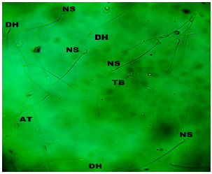 Image for - Evidences for Spermatozoa Toxicity and Oxidative Damage of Cadmium Exposure in Rats