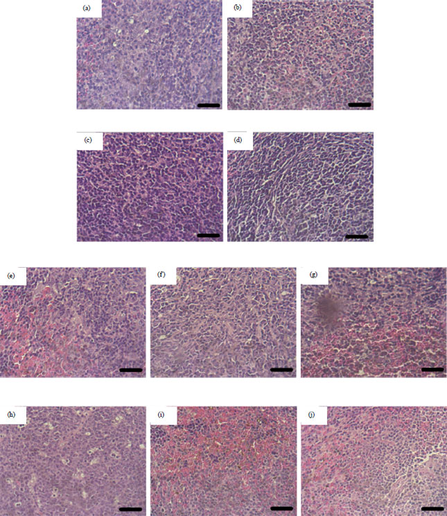Image for - Intraperitoneal Acute Toxicity of Aluminum Hydroxide Nanoparticle as an Adjuvant Vaccine Candidate in Mice