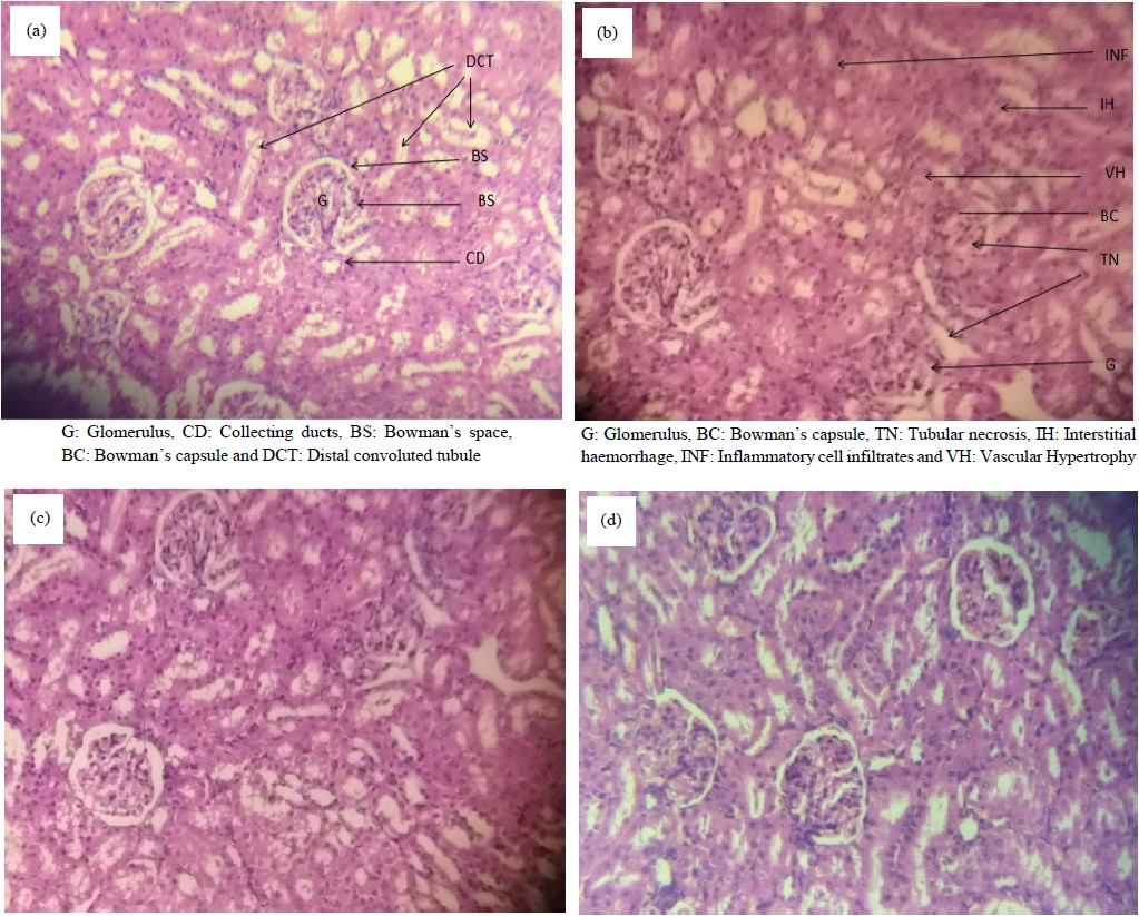 Image for - Antinephrolithiatic Effect of Plantain Juice from Musa paradisiaca Stem on Ethylene Glycol-Induced Renal Calculus in Experimental Wistar Rats