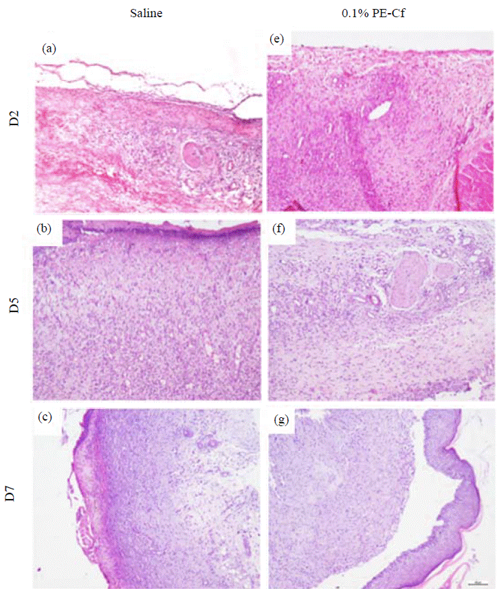 Image for - Polysaccharide-Rich Extract of Caesalpinia ferrea Stem Barks Modulates Inflammatory and Proliferative Phases Enhancing Diabetic Cutaneous Wound
