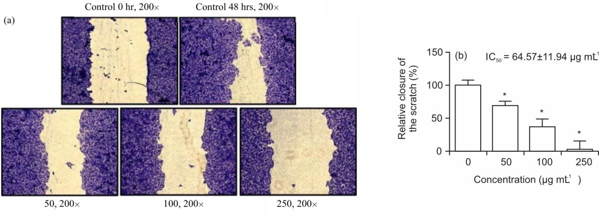Image for - Zanthoxylum rhetsa (Roxb.) DC Oil Suppresses the Proliferation, Activates Apoptosis, Inhibits Migration of Human Cervical Cancer Cells