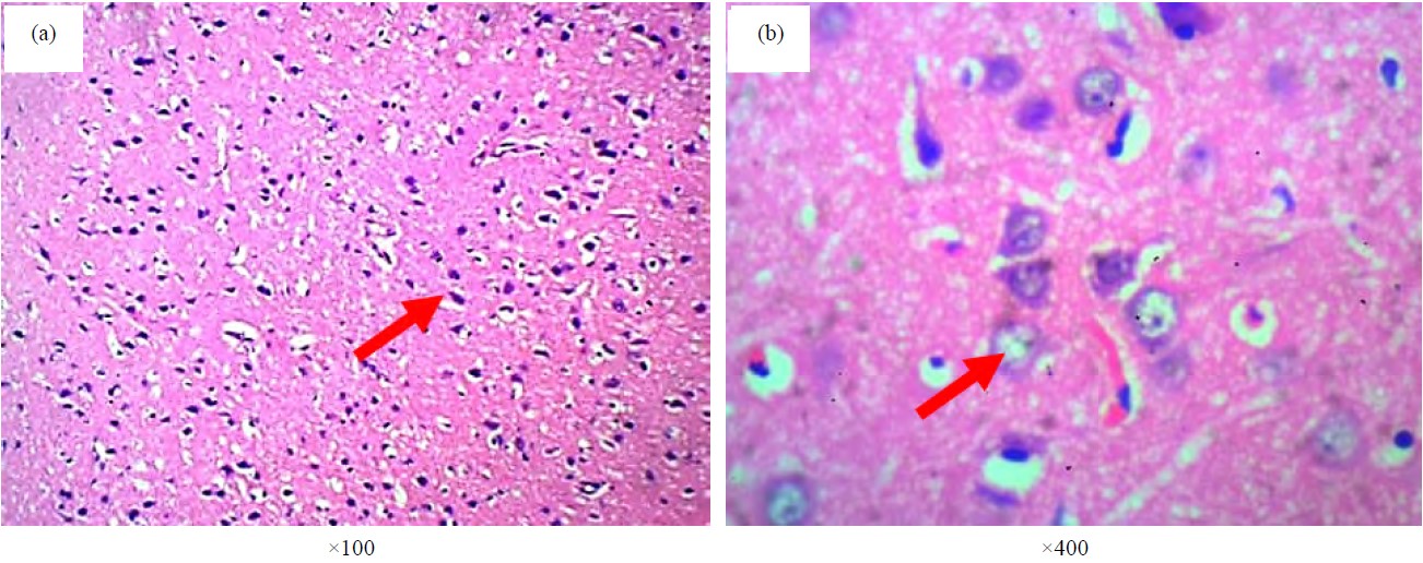 Image for - Neurological Effects of Cobalt Chloride on the Cerebral Cortex of Adult Wistar Rats