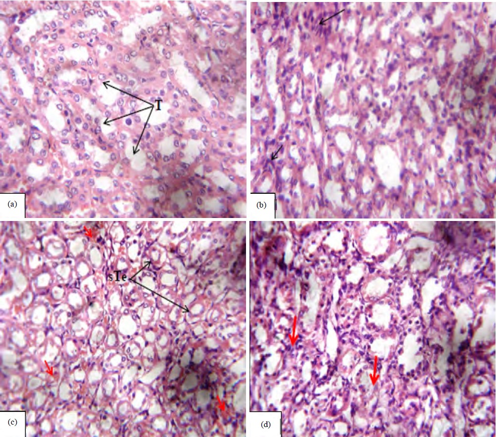 Image for - Comparative in vivo Evaluation of Rat Liver and Kidney Histomorphology Following Treatments with Doxorubicin, Acetaminophen and Anti-Tubercular Drugs