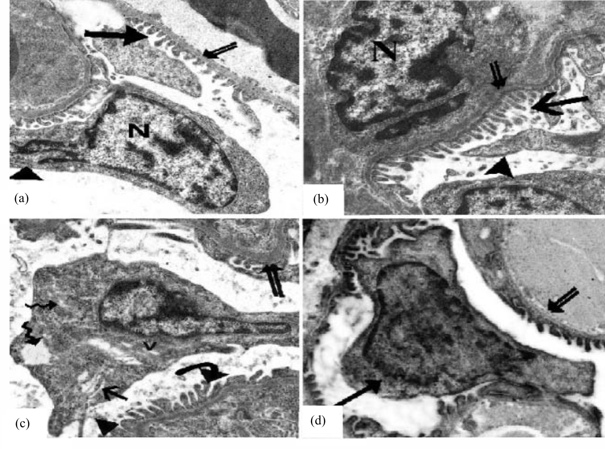 Image for - Protective Effect of Carob Pods Extract on Esomeprazole-Induced Changes on the Renal Cortex of Rats: Histological, Immunohistochemical and Statistical Study