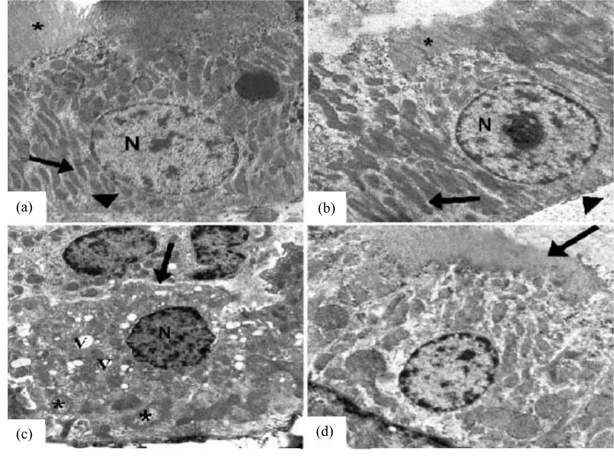 Image for - Protective Effect of Carob Pods Extract on Esomeprazole-Induced Changes on the Renal Cortex of Rats: Histological, Immunohistochemical and Statistical Study