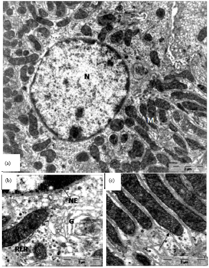 Image for - Renoprotective Effect of Date Fruit Extract on Ochratoxin (A) Induced-oxidative Stress in Distal Tubules of Rat: A Light and Electron Microscopic Study