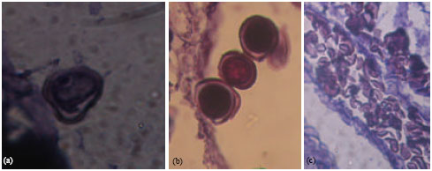 Image for - A normal Micro- and Megagametophyte Development in Brassica napus Induced by High Salinity