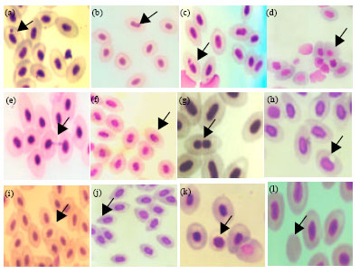Image for - Nuclear and Cytoplasmic Abnormalities in the Fish Catla catla (Hamilton) Exposed to Chemicals and Ionizing Radiation