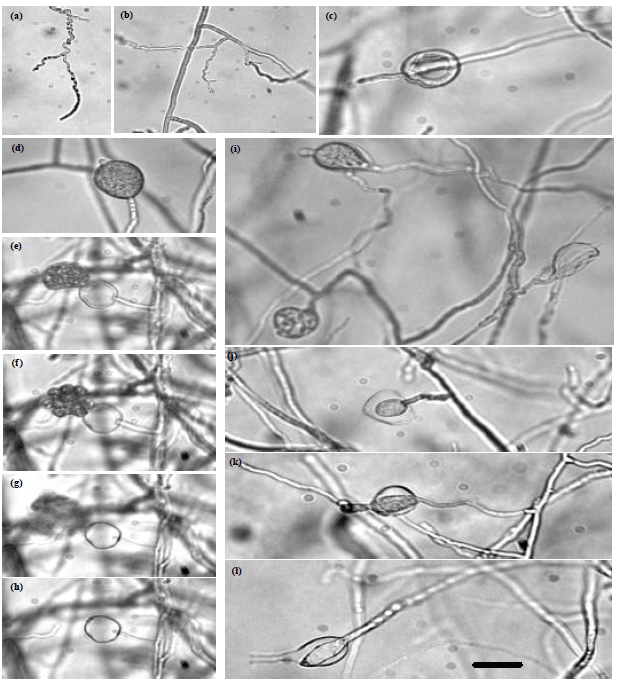 Image for - Occurrence, Identification and Pathogenicity of Pythium aphanidermatum, P. diclinum, P. dissotocum and Pythium "Group P" Isolated from Dawmat Al-Jandal Lake, Saudi Arabia