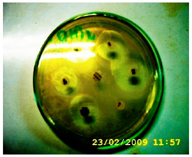 Image for - Evaluation of Physico-chemical and Antimicrobial Susceptibility Patterns of Microorganisms Isolated from Awetu River, Jimma Town