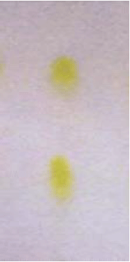 Image for - Remediation of Iron Using Rhamnolipid-Surfactant Produced by Pseudomonas aeruginosa