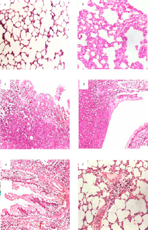 Image for - Influence of Green Tea on Haematological and Lung Histological Disorders Induced by Malathion in Rats
