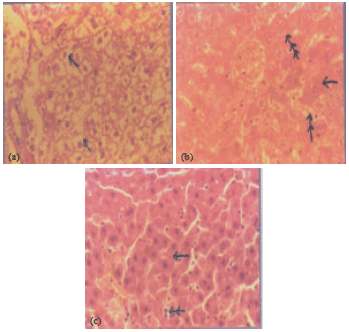 Image for - Hepatotoxic and Nephrotoxic Effects of Kerosene and Petrol-Contaminated Diets in Wistar Albino Rats