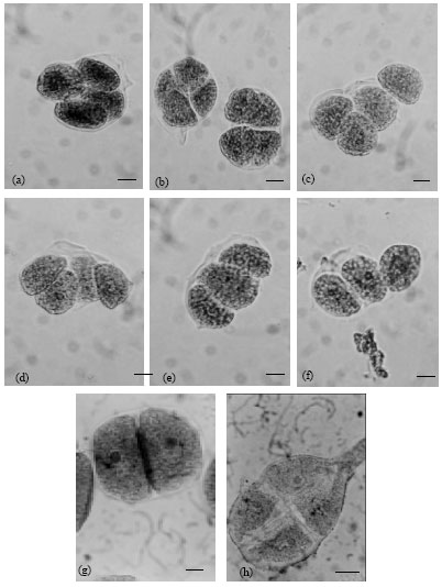 Image for - Evaluation of the Genotoxicity of Residual Repeated Applications of Sewage Sludge on M2 Meiocytes of Zea Plants