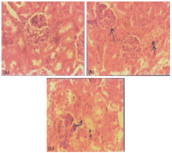 Image for - Hepatotoxic and Nephrotoxic Effects of Kerosene and Petrol-Contaminated Diets in Wistar Albino Rats