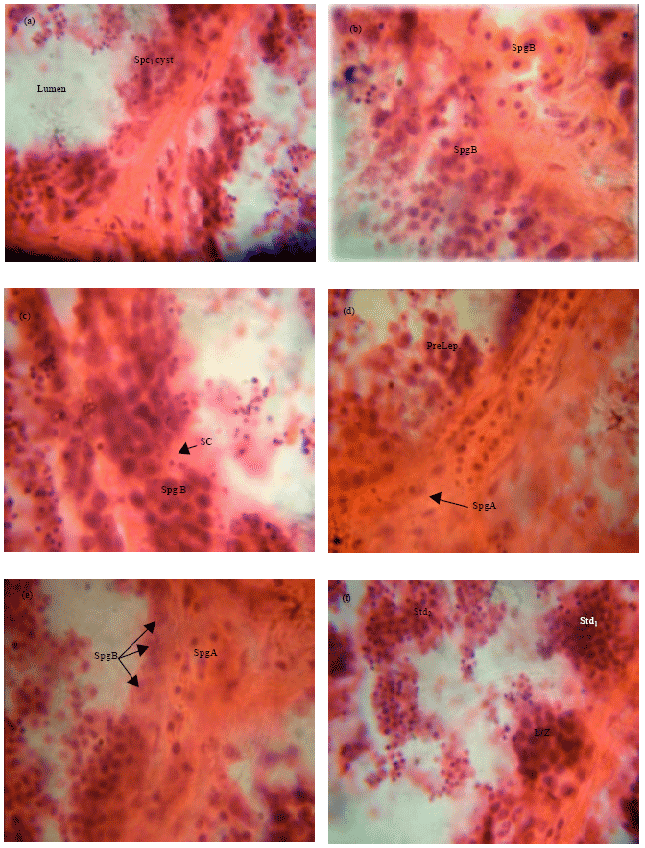 Image for - Effect of Sublethal Concentrations of Aqueous Extract of Lepidagathis alopecuroides on Spermatogenesis in the Fresh Water Catfish Clarias gariepinus