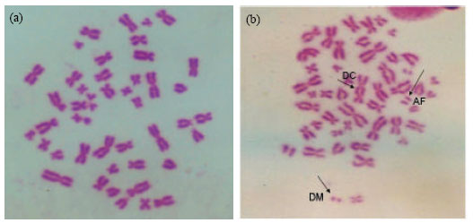 Image for - Radon-induced Chromosome Damage in Blood Lymphocytes of Smokers