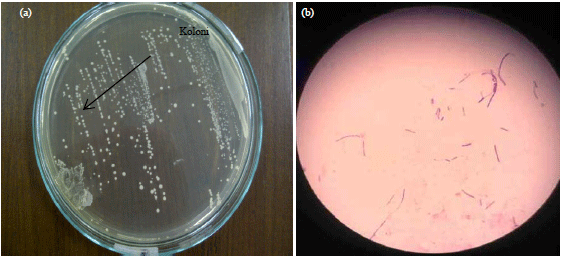 Effect of Munghurt Lactobacillus acidophilus from Green Beans to Blood ...