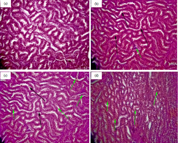 Image for - Acute and Sub-chronic Toxicity Evaluation of Crude Methanolic Leaves Extract of Acacia nilotica (Linn.)