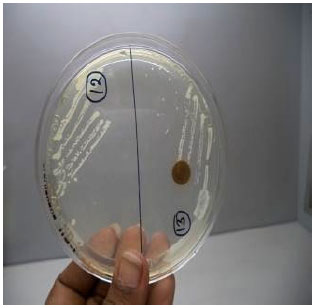 Image for - Incidence and Pattern of Antibiotic Resistance of Staphylococcus aureus Isolated from Clinical and Subclinical Mastitis in Cattle and Buffaloes