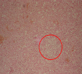 Image for - Clinical and Histopathological Observations of Turkey Hepatic Lipidosis in the Ain Touta Area (Algeria): A Preliminary Report