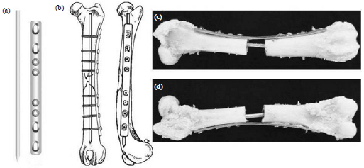 Image for - Biomechanical Comparison of Plate-Nail Vs. Plate-Rod for Experimentally-Induced Gap Fractures in ex vivo Canine Femora