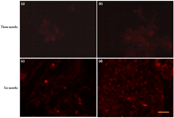 Image for - Long Term Evaluation of Human Umbilical Cord Blood Mesenchymal Stem Cells in the Management of Total Coronary Occlusion (Experimental Study in Dogs)