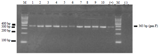 Image for - Molecular Pathotyping of Newcastle Disease Virus from Naturally Infected Chickens by RT-PCR and RFLP Methods