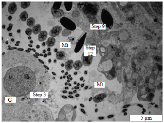 Image for - Ultrastructural Changes Occurring During Spermiogenesis of the Vervet Monkey, Chlorocebus aethiops