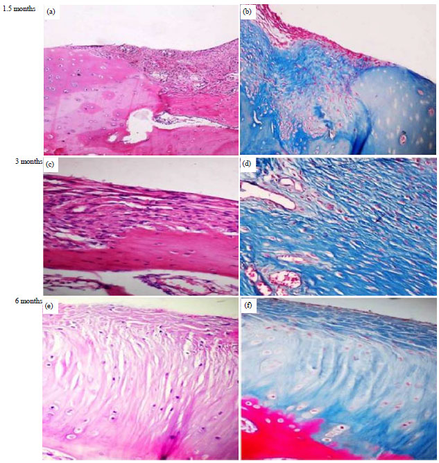 Image for - Evaluation of Low Level Laser-Activated Stromal Vascular Fraction as a Single Procedure for Treatment of Experimental Chondral Defects