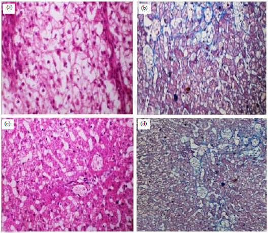 Image for - Role of Hepatocyte Differentiated Mesenchymal Stem Cells in Treatment of Experimentally Induced Canine Liver Cirrhosis