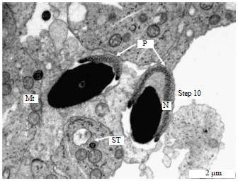 Image for - Ultrastructural Changes Occurring During Spermiogenesis of the Vervet Monkey, Chlorocebus aethiops