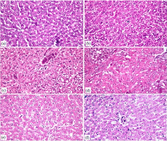 Image for - Cytoprotective Effect of Silymarin on Cisplatin Induced Hepatotoxicity and Bone Marrow Toxicity in Rats