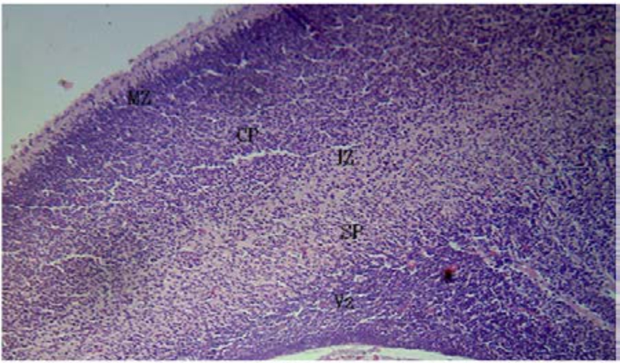 Image for - Evaluation of Leaf Extracts of Costus afer on Foetal Morphology and Cerebral Cortex Using Rat Model