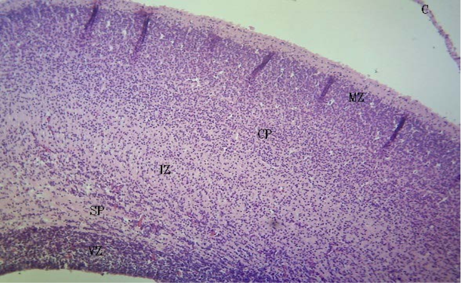 Image for - Evaluation of Leaf Extracts of Costus afer on Foetal Morphology and Cerebral Cortex Using Rat Model