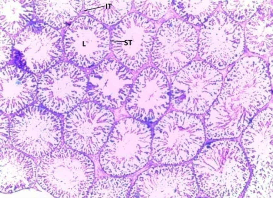 Image for - Histopathological Changes of Some Internal Organs and Brain Regions of Rabbits Fed Dietary Cassava Peel Meal as Replacement for Maize