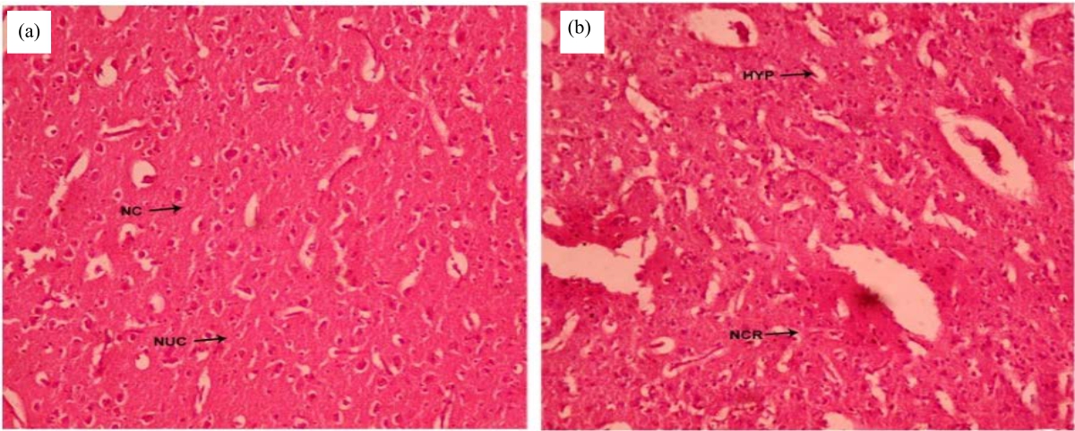 Image for - Mycotoxigenicity of Territrem B: Histopathological Investigations of Chick Ingesting Aspergillus terreus Infested Feed