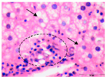 Image for - Dietary Olive Oil Effect on the Histopathological Alterations Caused by Mixture of Saturated Fats in Both Aorta and Liver of Rat