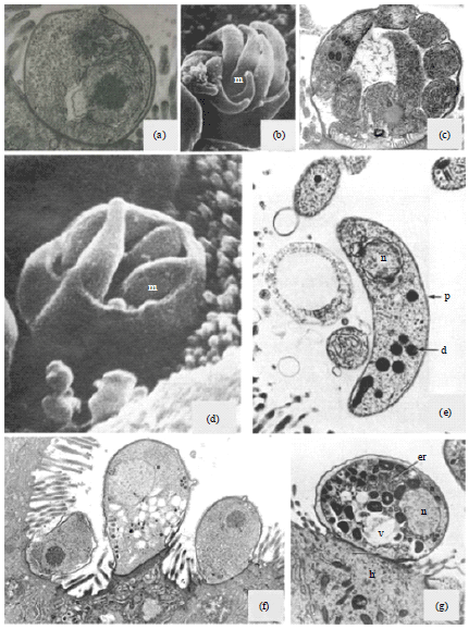 Image for - Cryptosporidiosis in Animals and Man: 2. Diagnosis