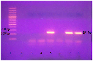Image for - Molecular Detection and Genotyping of Toxoplasma gondii from Egyptian Isolates