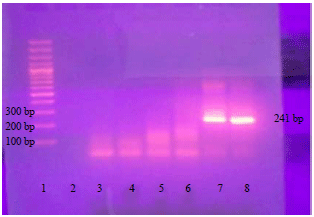 Image for - Molecular Detection and Genotyping of Toxoplasma gondii from Egyptian Isolates